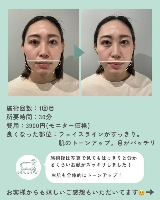 画像398