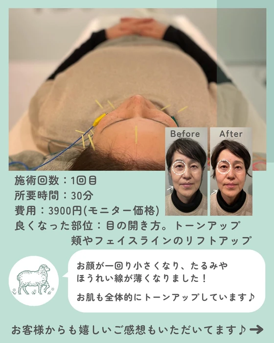 画像625